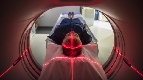 Új rákszűrési módszert dolgoztak ki
