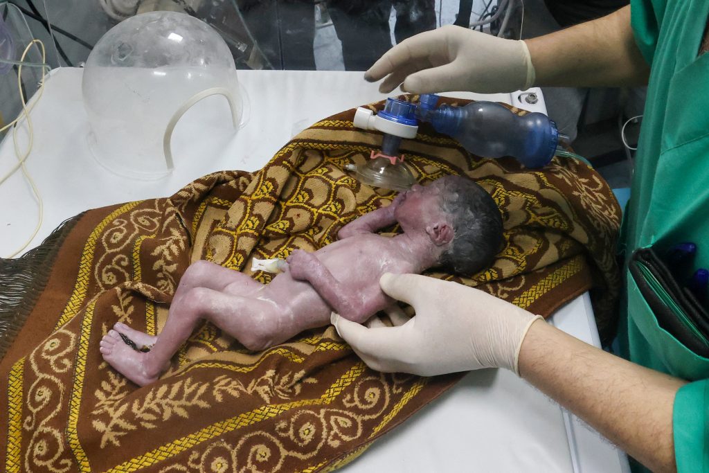 Meghalt a csecsemő, akit haldokló anyja méhéből mentettek ki egy izraeli légicsapás után