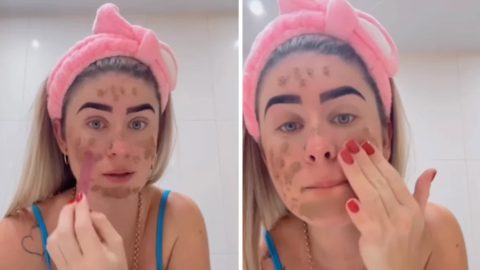 Saját székletével próbálja megóvni az arca fiatalságát egy brazil influenszer – videó