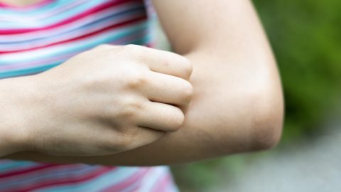 Ezért viszket egyeseknek jobban a szúnyogcsípés