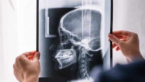Több mint 300 csontot vettek ki a hamvasztásra váró holttestek koponyájából – elítélték a volt klinikaigazgatót és a boncmestert