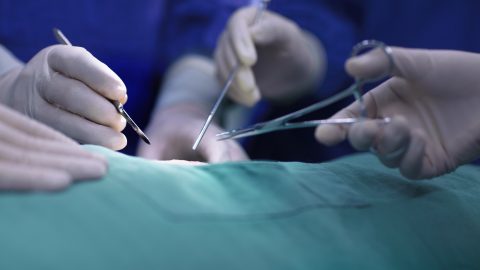 A fájdalomtól üvöltve ment be egy férfi a kórházba, egy csipeszt találtak a húgycsövében