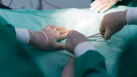 Parazita ikret kellett eltávolítani egy indiai fiú testéről