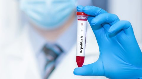Hepatitisz A: mennyire veszélyes ez az új járvány?