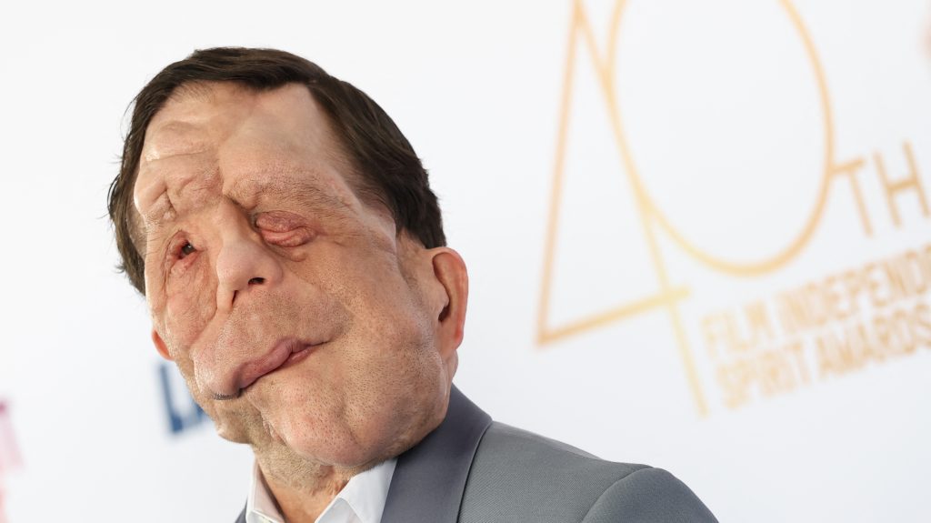 Adam Pearson játszhatja el az elefántembert