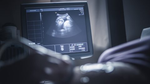 Rémisztő hatással van a csecsemőkre és várandósokra a klímaváltozás
