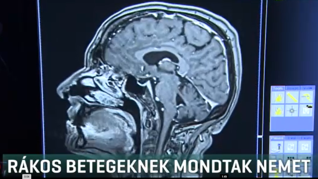 Magáncégek nem végezhetnek CT- és MR-vizsgálatot állami finanszírozásban