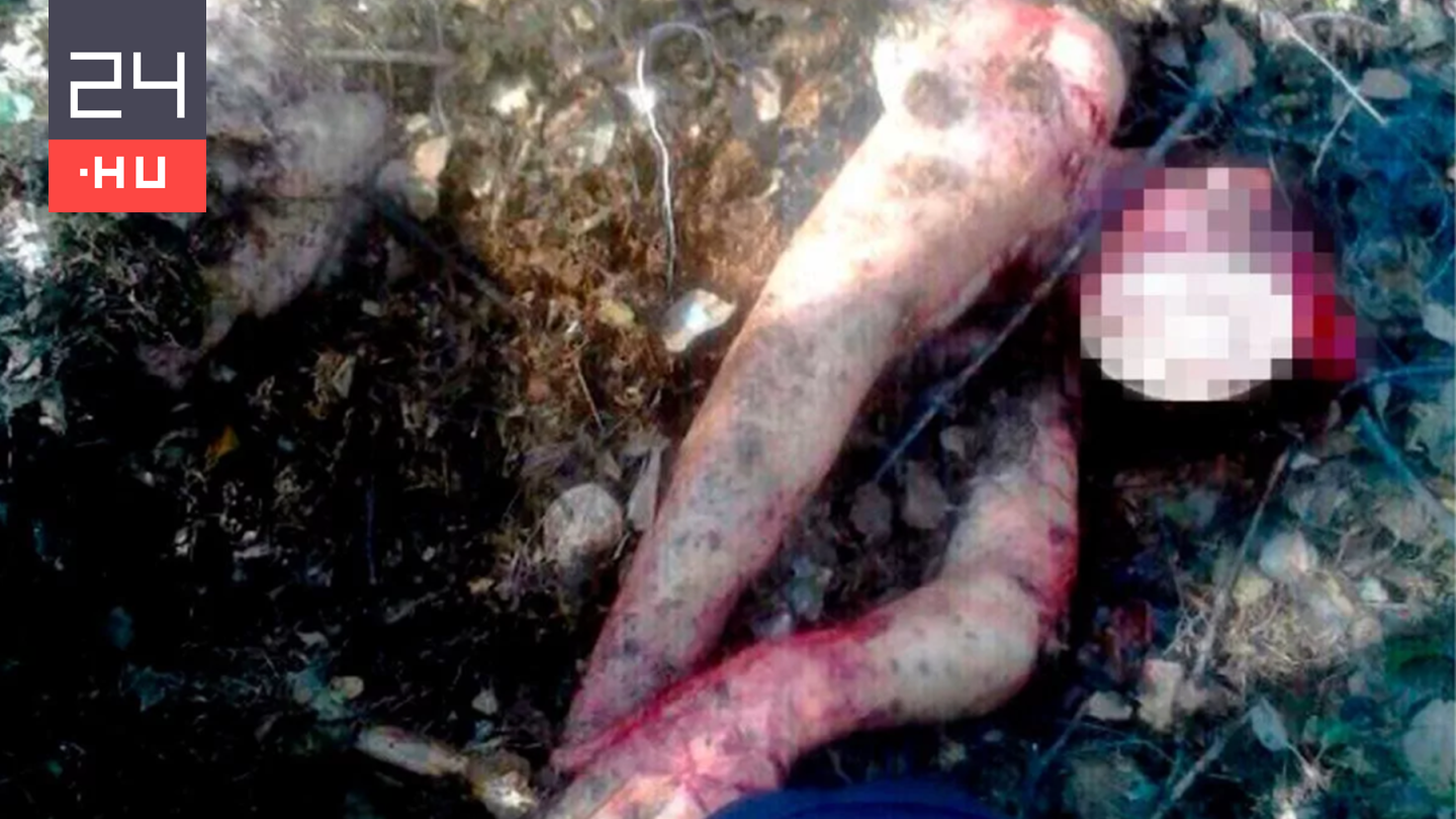 Megskalpolta egy medve, csodával határos módon mégis túlélte az orosz nő