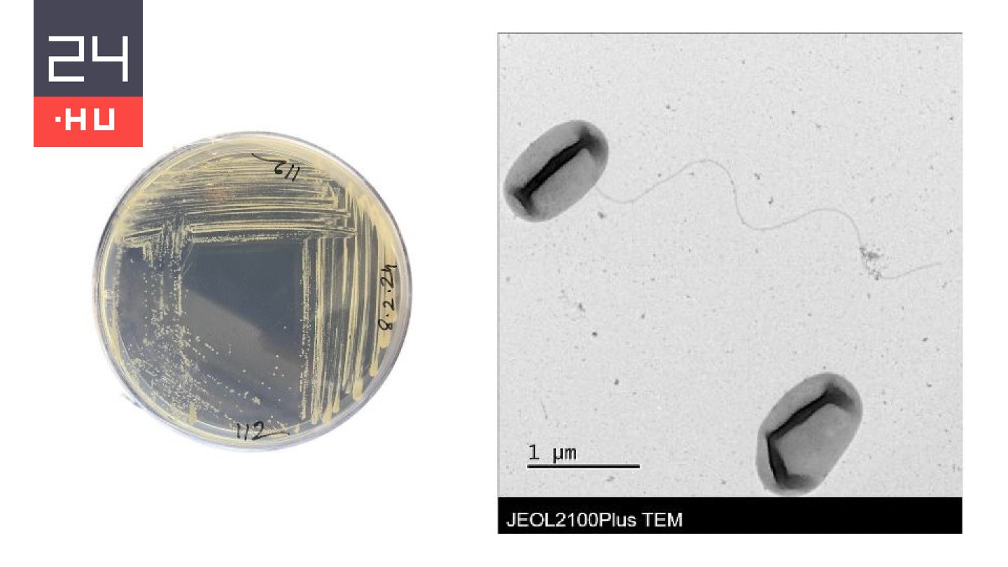 Ismeretlen baktériumot fedeztek fel magyar kutatók