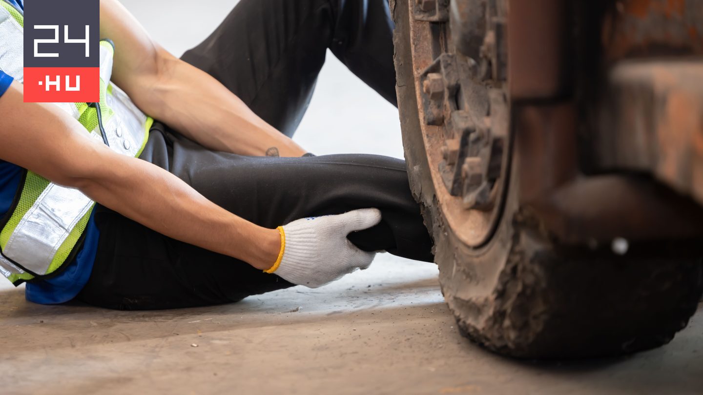 Egy targoncabaleset után levágták a lábát, a bíróság mégis megtagadta az egymillió fontos kártérítési igényét