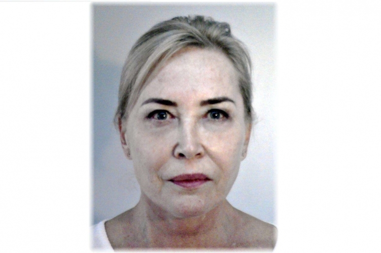 Megműtötték, majd eltűnt egy orvosnő a szegedi kórházból