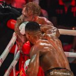 Jake Paul Anthony Joshua állkapocstörés műtét platinalemez