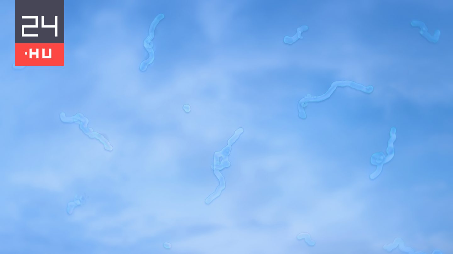 Mik azok az apró, féregszerű struktúrák, amelyek időnként megjelennek a szemünk előtt?
