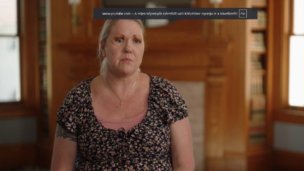 „Megette az arcát” egy fertőzés, miután autóbalesetet szenvedett a nő