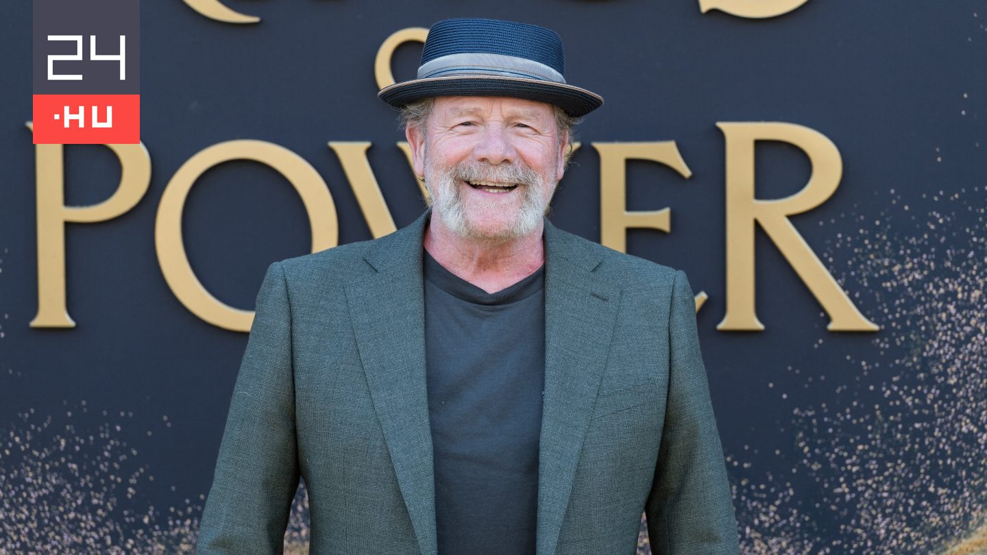 Megpróbált megakadályozni egy utcai verekedést, fejsérülést szerzett a Trainspotting színésze