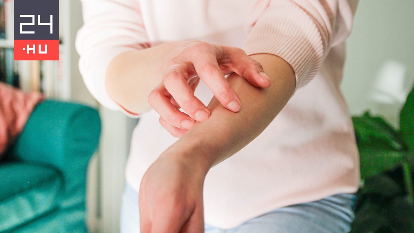 Ez a teendő, ha bőrpanaszaink vannak a téli hidegben