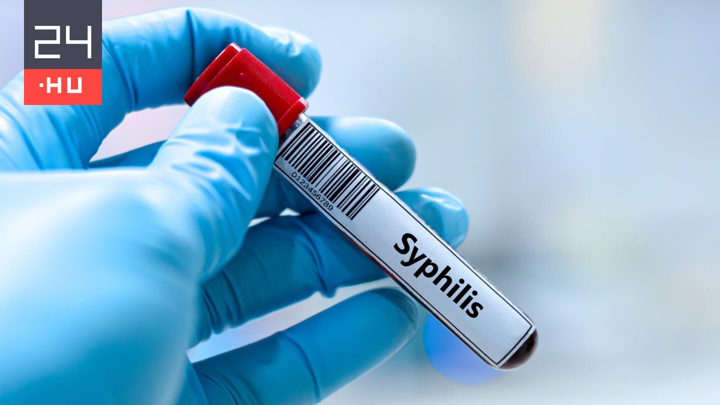 Tiszavasvári polgármestere cáfolta lapunknak, hogy egyre több lenne a szifiliszes beteg