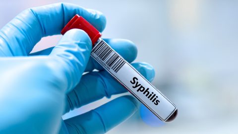 szifilisz, vizsgálat, nemi betegség