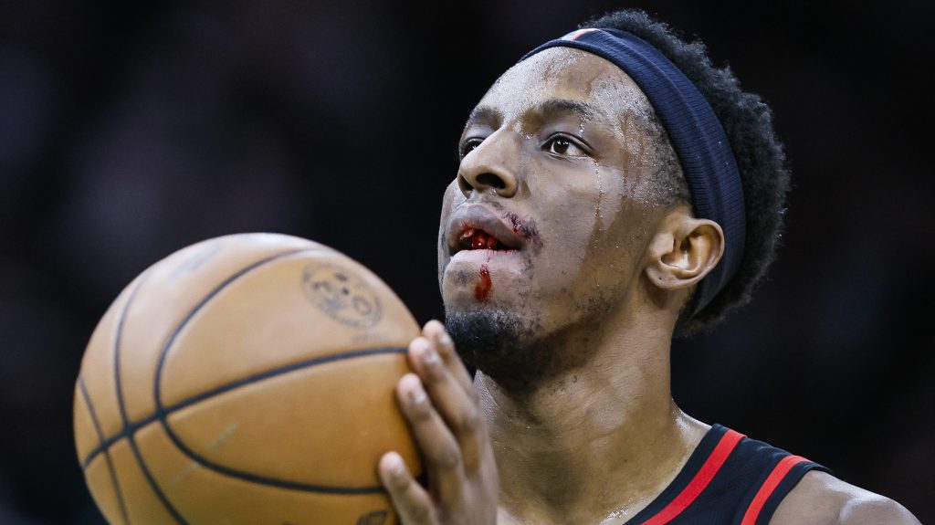 Kivérték a fogát egy kosarasnak, ömlött a vér az NBA-meccsen