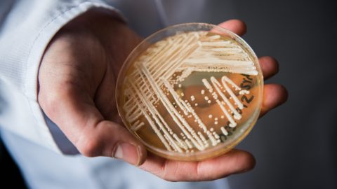 Candida auris gyógyszerrezisztens, halálos gombafaj egy laboratóriumban.