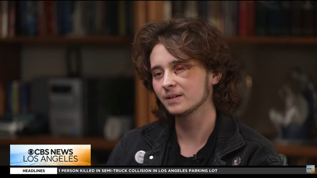 „Érme nagyságú műanyagdarabot szedtek ki a szememből” – megszólalt az ICE-ügynök által megvakított fiatal