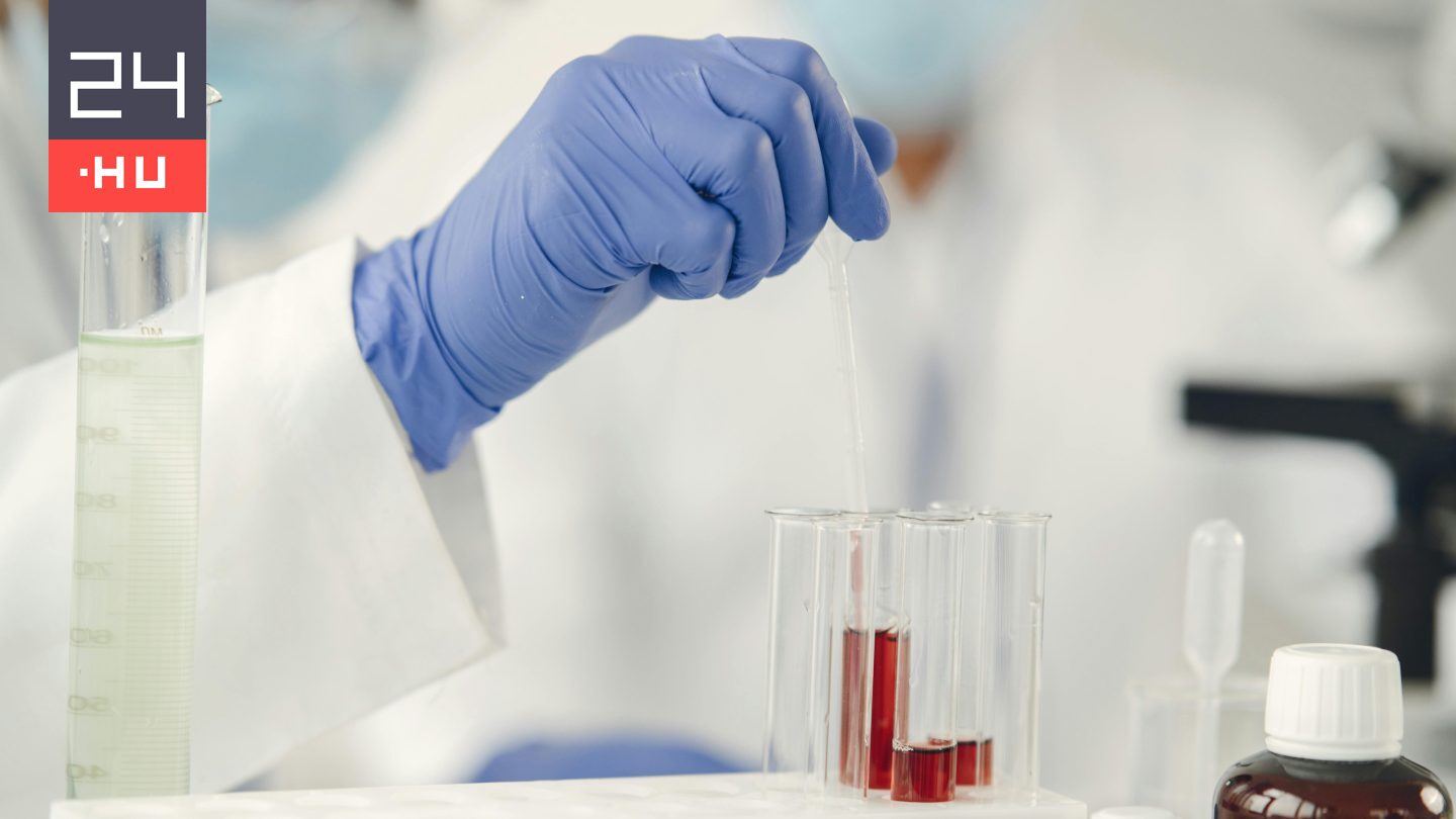 Ez jelzi legkorábban a vashiányt