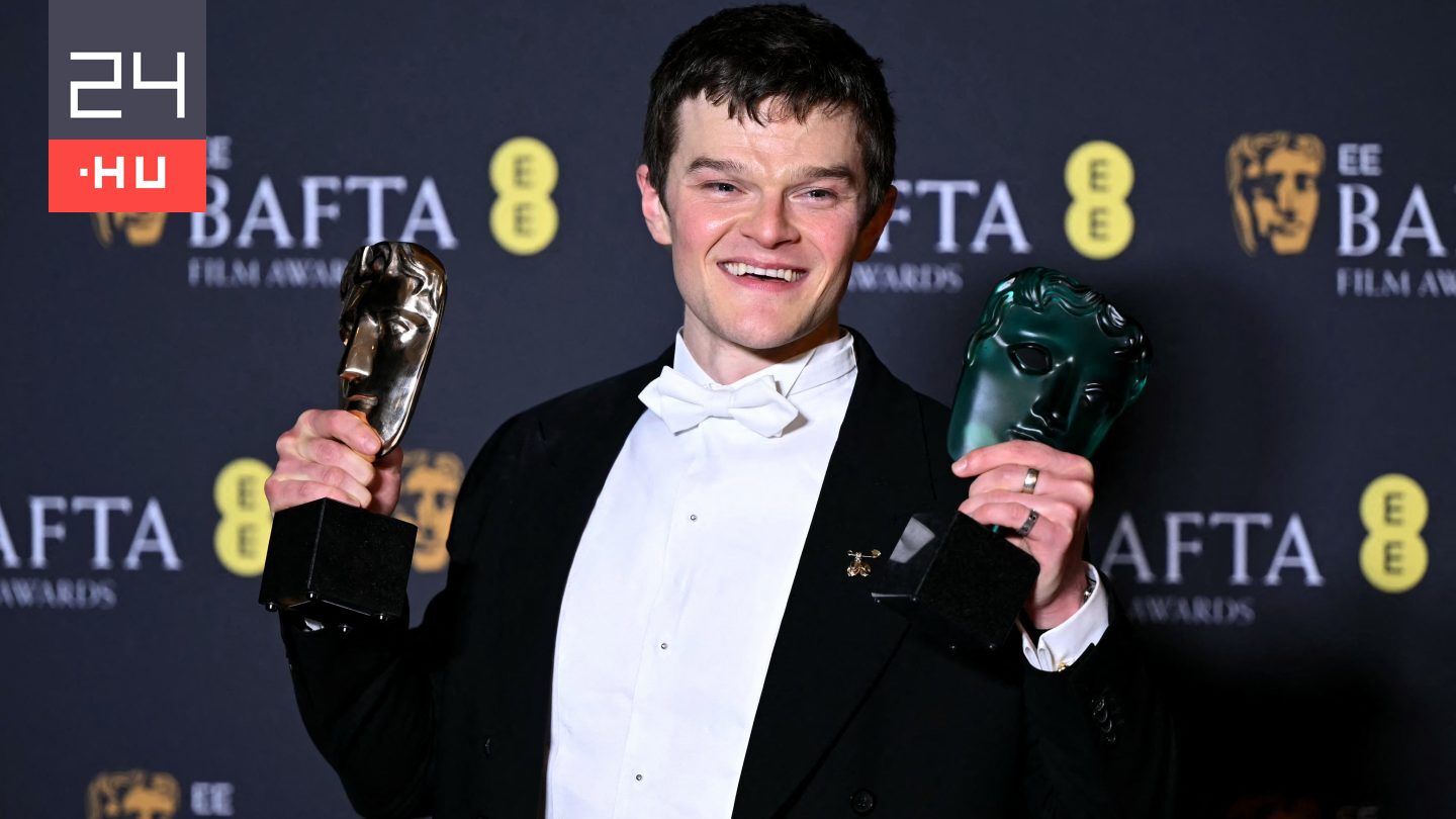 Trágár bekiabálásoktól volt hangos az idei BAFTA, a műsorvezető megértést kért a Tourette-szindrómás aktivistának