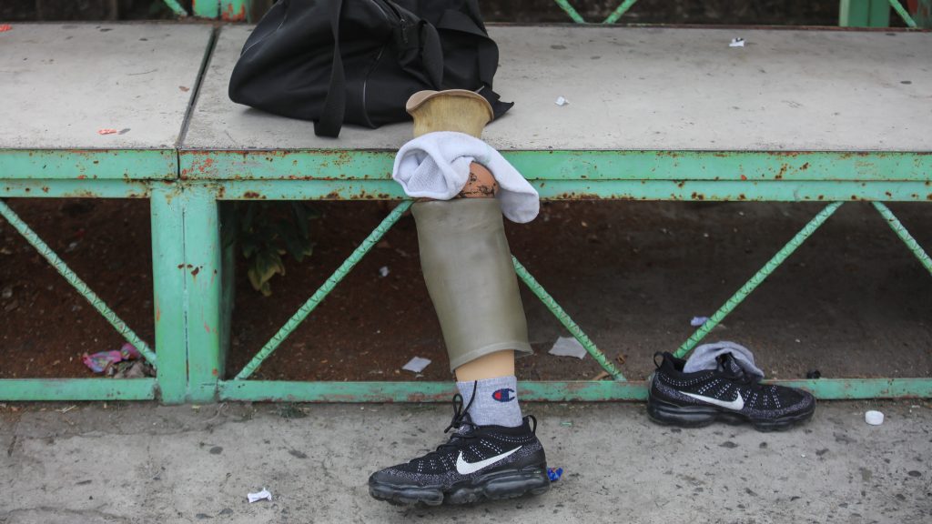 30-40 eldobott műlábat találtak vadászok egy bokor alatt