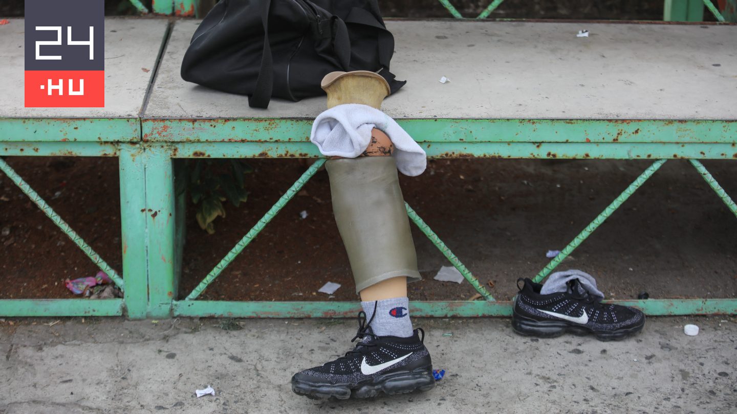 30-40 eldobott műlábat találtak vadászok egy bokor alatt