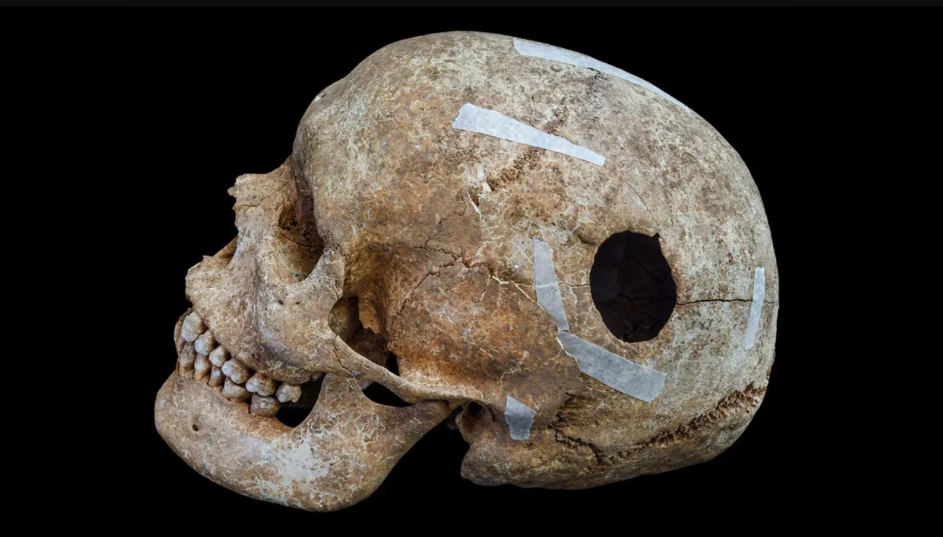 cambridge, régészet, ásatás, óriás, kutatás, csontvázak, kivégzés, csata, harc