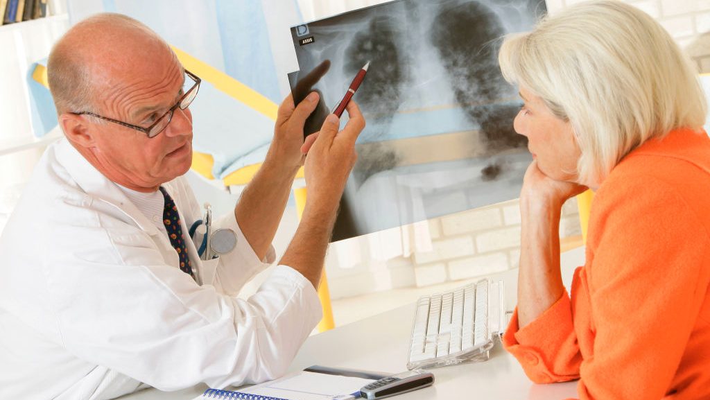 TBC-s lett egy hódmezővásárhelyi tanár, 250 kontaktot vizsgálnak