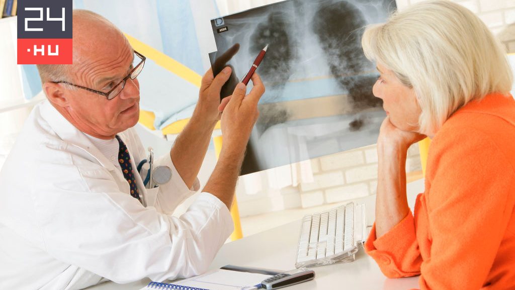 TBC-s lett egy hódmezővásárhelyi tanár, 250 kontaktot vizsgálnak