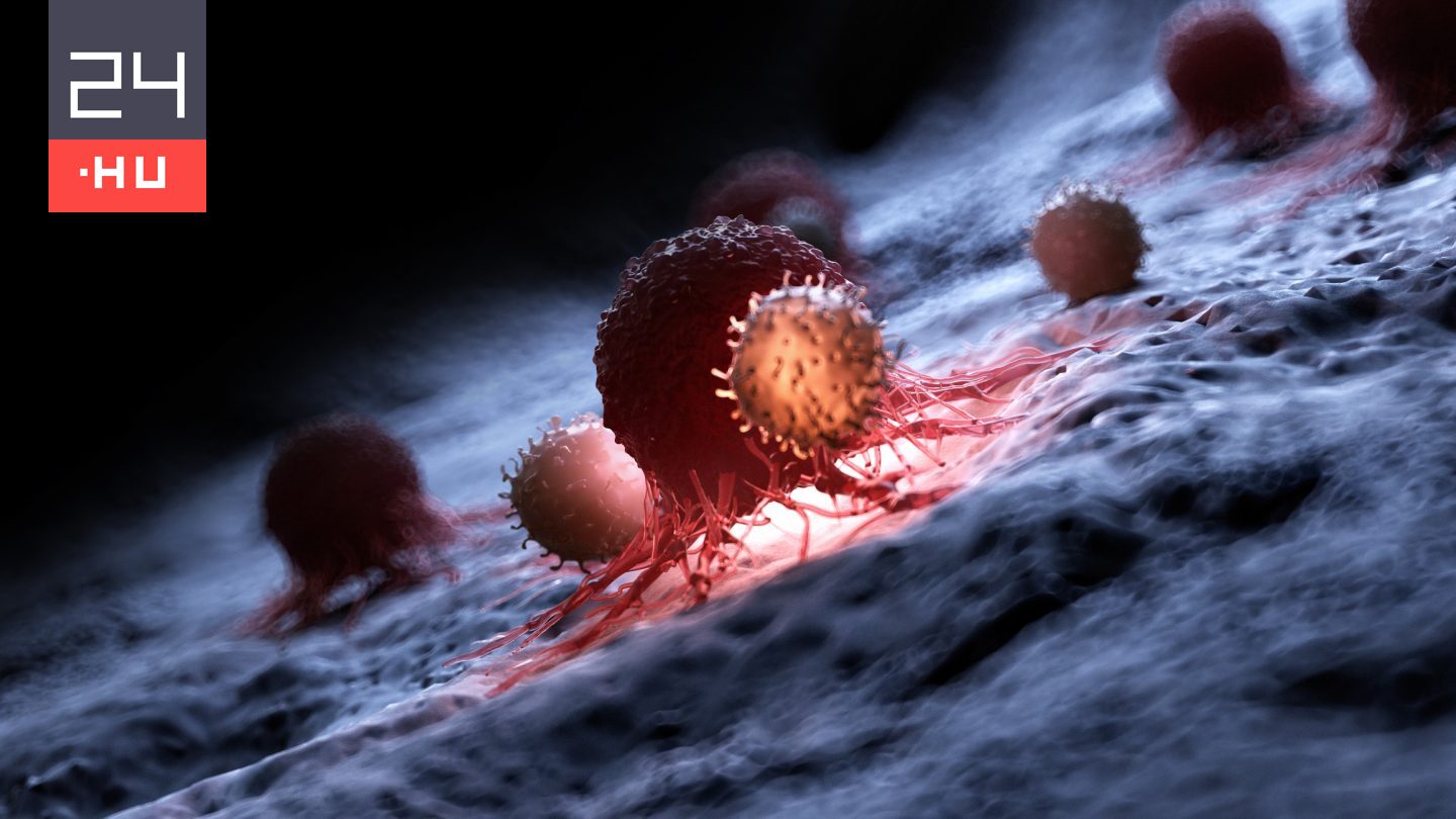 Ezért lehetnek láthatatlanok bizonyos daganatok