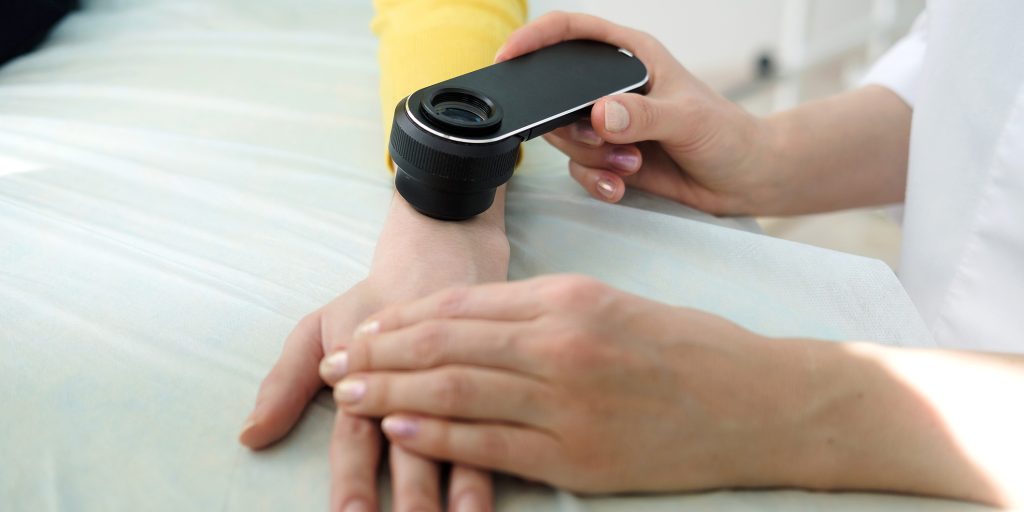 Új bőrvizsgálattal mutathatók ki a szívbetegség korai jelei