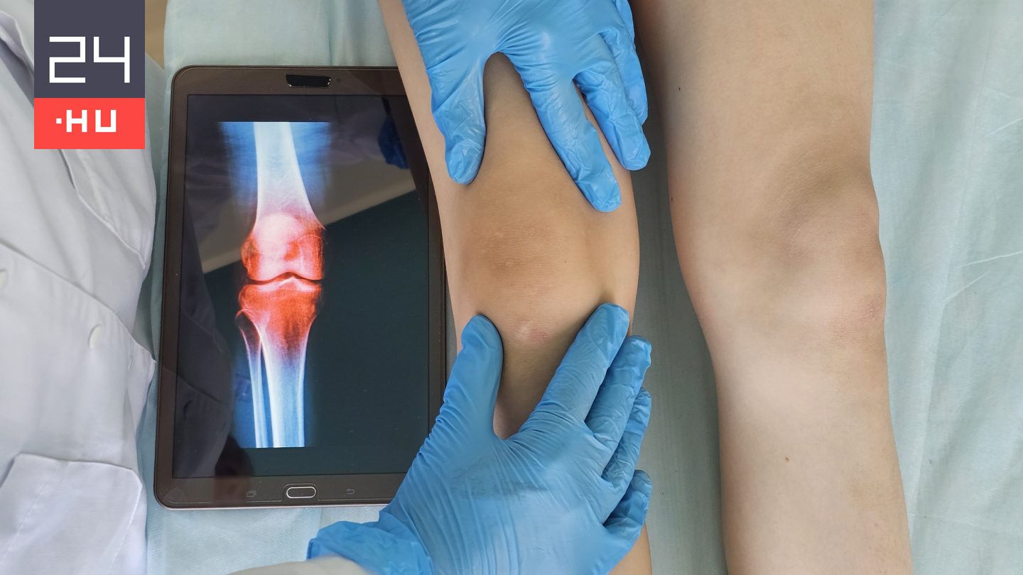 Először végeztek lábhosszabbító műtétet gyermeken Angliában