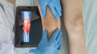 térd, fiú, láb, lábhosszabbítás, műtét, kutatás