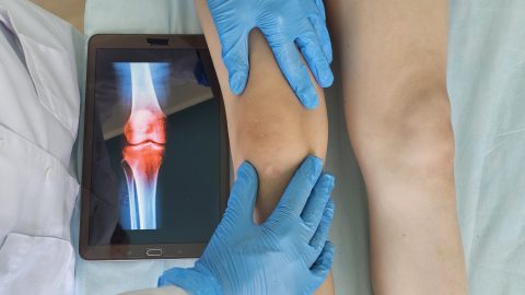 térd, fiú, láb, lábhosszabbítás, műtét, kutatás