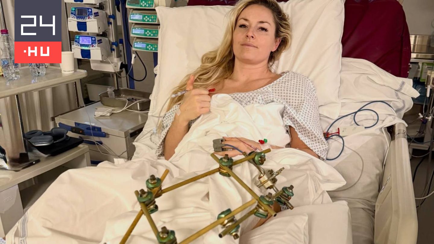 Lindsey Vonn ripityára tört sípcsontját öt nap alatt harmadszor is megműtötték