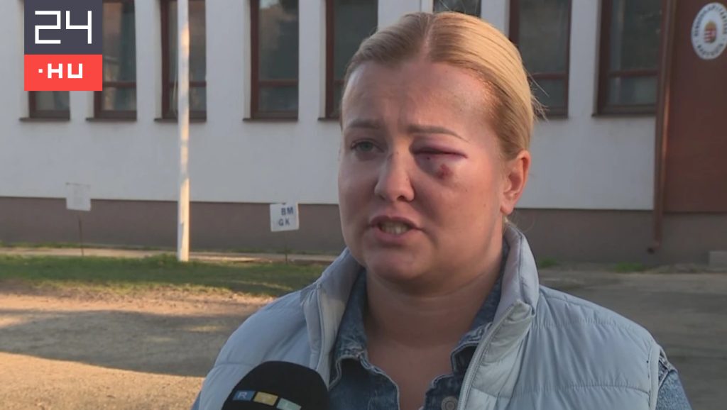 Politikai nézetkülönbség miatt fajulhatott el a vita – állítja a nő, akit összevert a szentmártonkátai alpolgármester