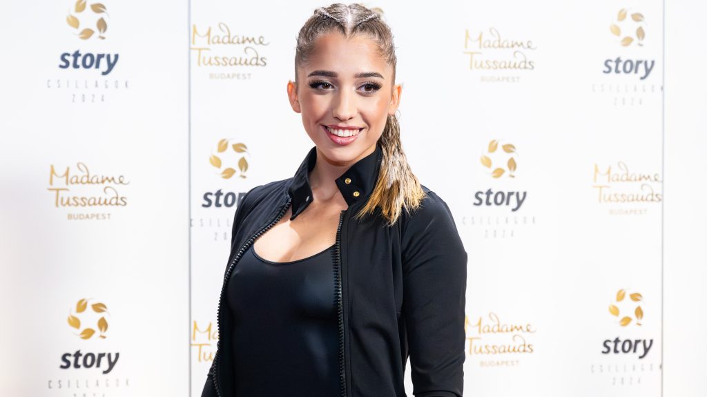 Schóbert Lara elmondta, milyen plasztikai beavatkozáson gondolkodik