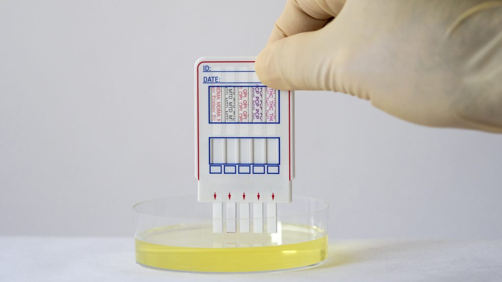 Kötelező drogteszt a politikusoknak? Az addiktológus szerint ez inkább „bohóckodás”