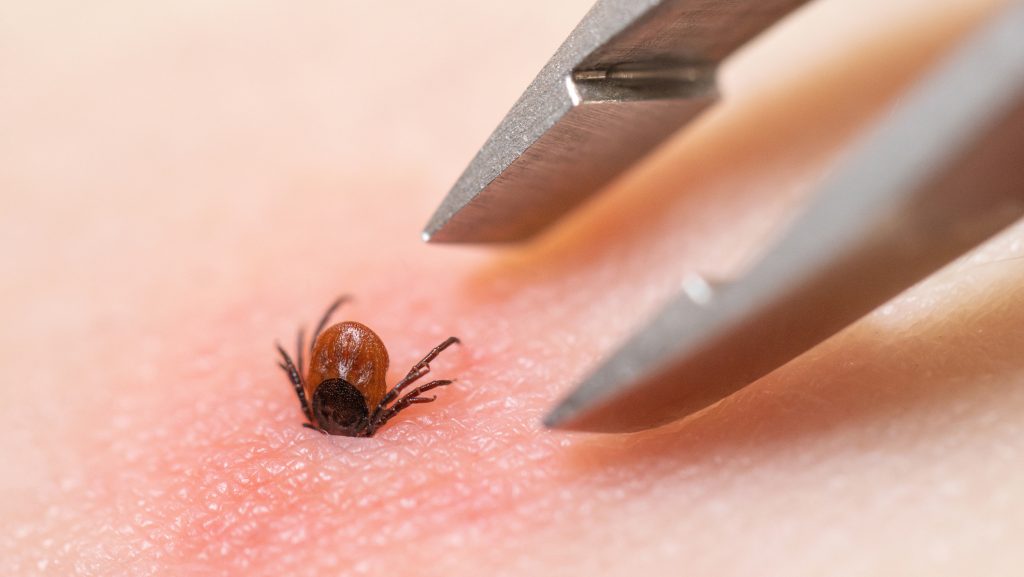 Áttörés jöhet a Lyme-kór elleni harcban: küszöbön a Pfizer vakcinája