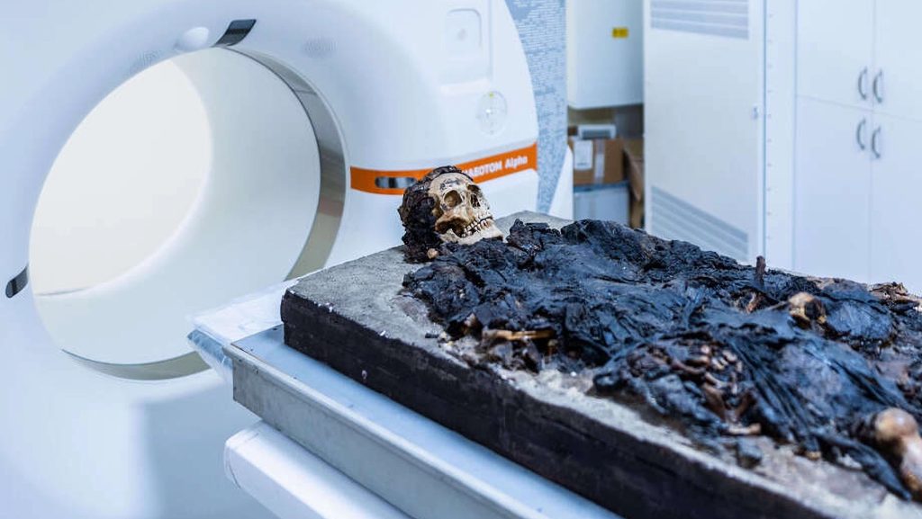 Budapesten talált római múmián végeztek CT-vizsgálatot