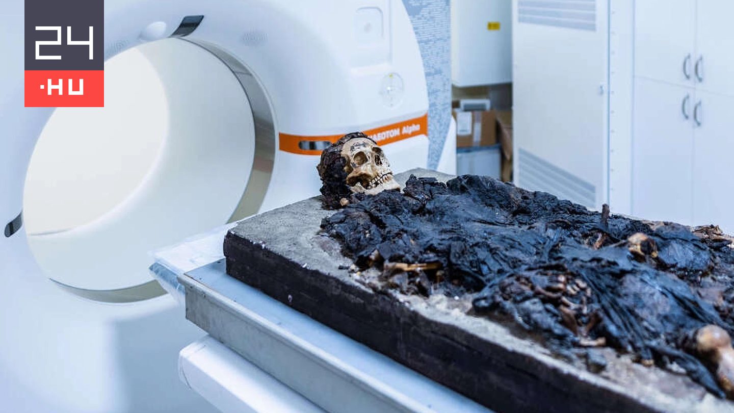 Budapesten talált római múmián végeztek CT-vizsgálatot