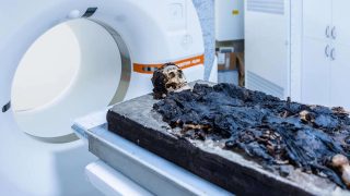 CT-vizsgálatnak vetettek alá egy Budapesten talált, római kori múmiát.