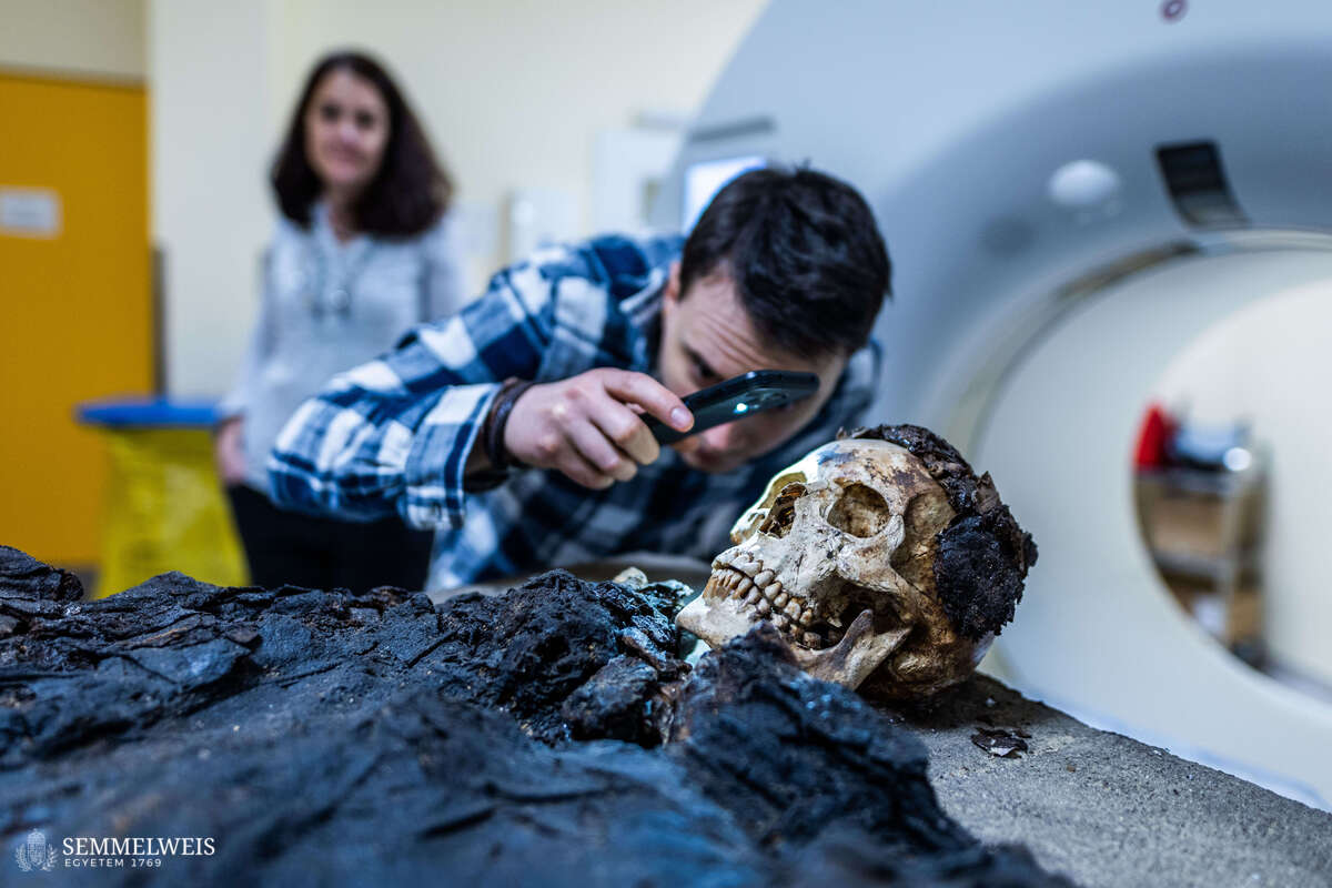 CT-vizsgálatnak vetettek alá egy Budapesten talált, római kori múmiát.