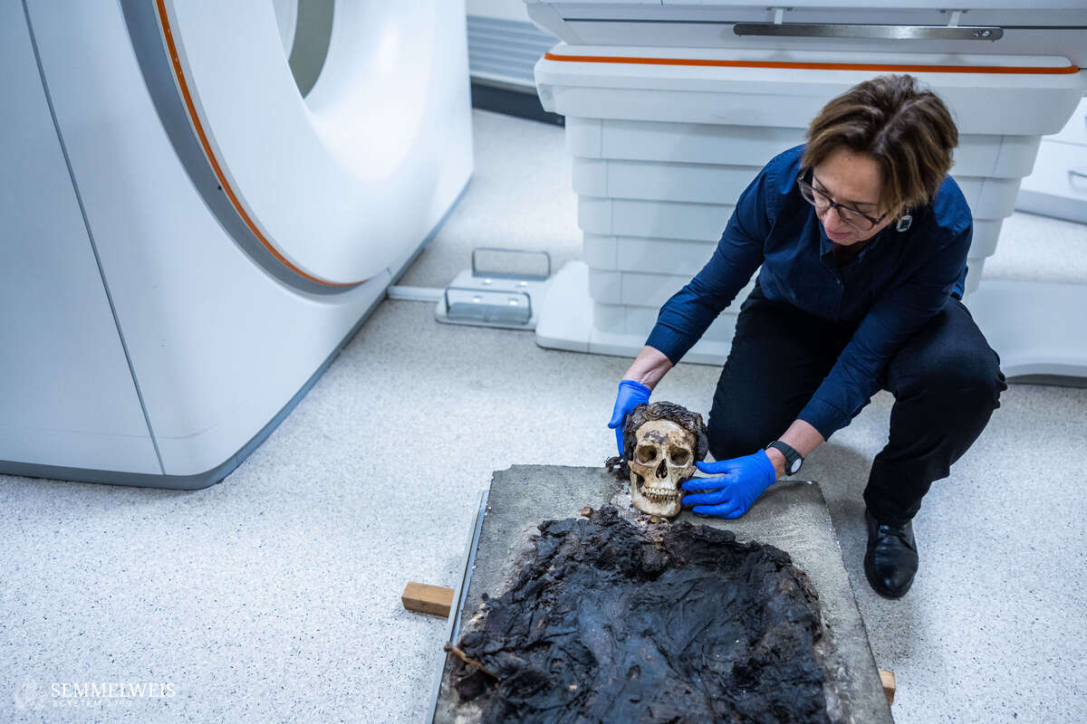 CT-vizsgálatnak vetettek alá egy Budapesten talált, római kori múmiát.