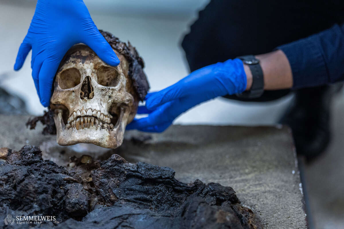 CT-vizsgálatnak vetettek alá egy Budapesten talált, római kori múmiát.