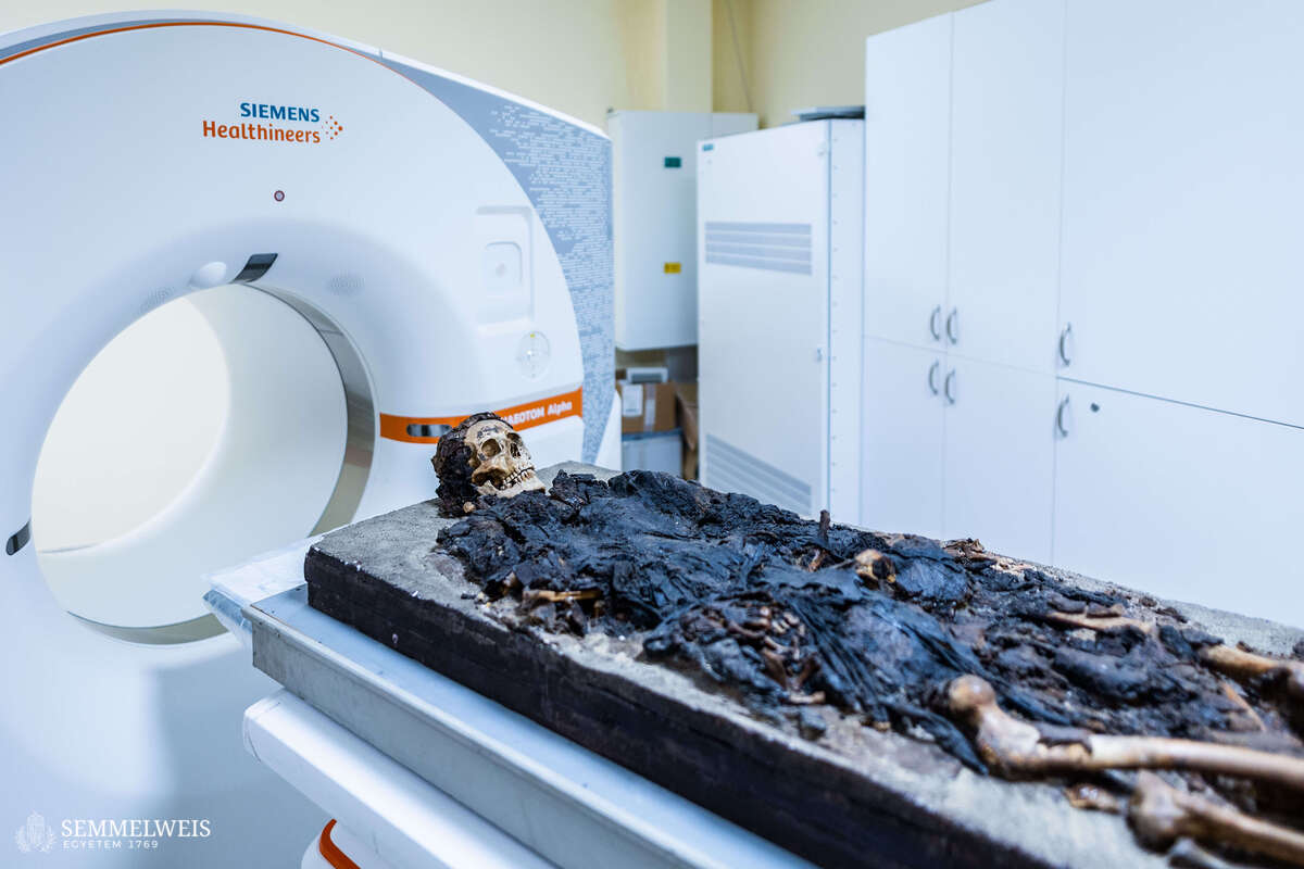 CT-vizsgálatnak vetettek alá egy Budapesten talált, római kori múmiát.