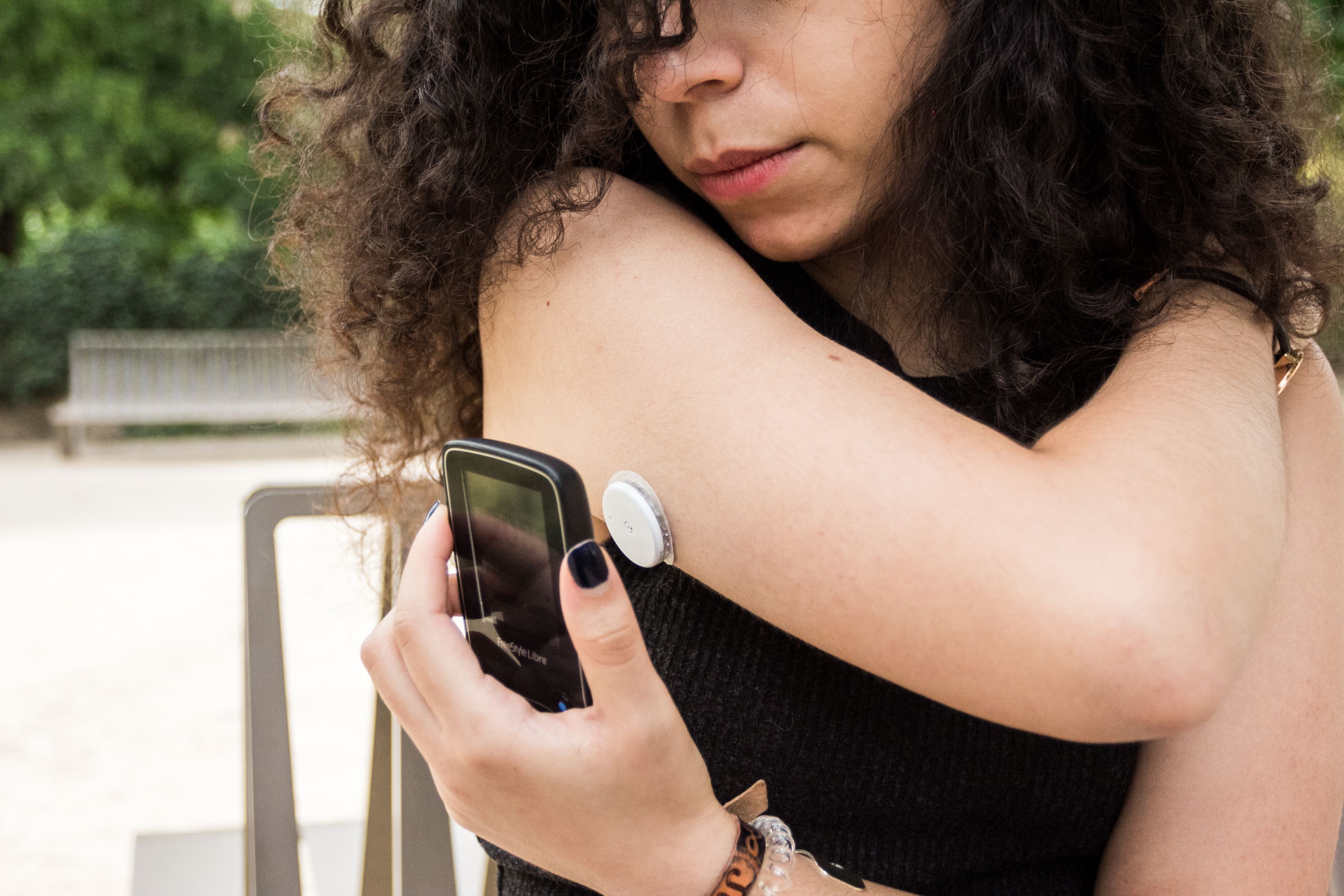 Vércukorszenzor egy fiatal nő karján.